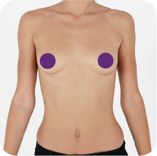 Breast photo demonstration